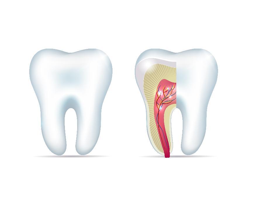 Diagram of tooth pain in root canal | Prosper Smiles 75078
