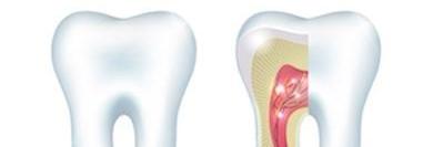 3D rendering of infected tooth l root canals prosper tx